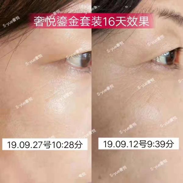 S-yue brand golden rejuvenating tightening series anti aging skin firming cosmetics