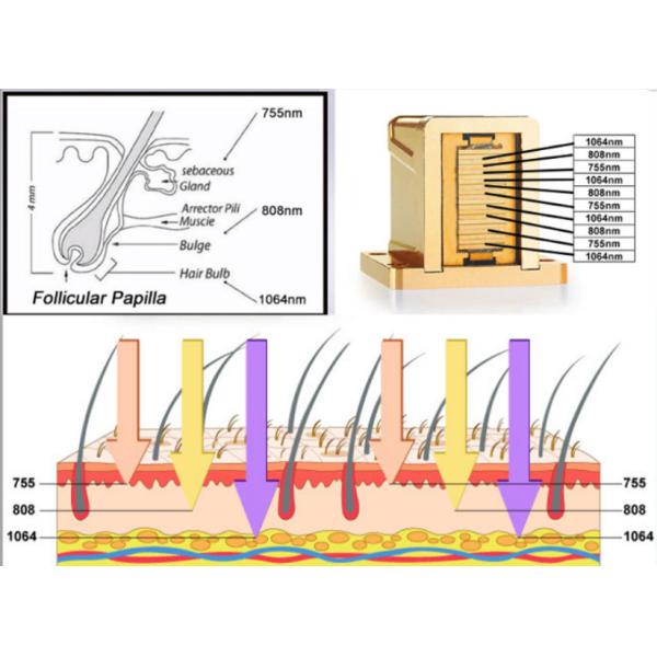 Portable Diode Laser Hair Removal Machine Diode Laser Hair Removal 2in1 Machine 3 Wavelength Laser and Diode Machine