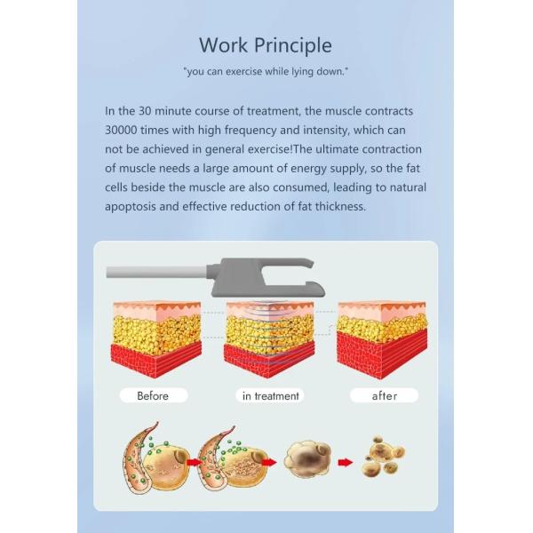 Мини-электрический стимулятор мышц Slim HI EMT для похудения