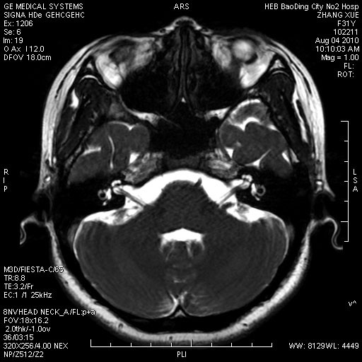 Сделайте голографический фильм водостойким КНД-А для термального принтера, АГФА 5300 кс Рэй сухой/5500/5302