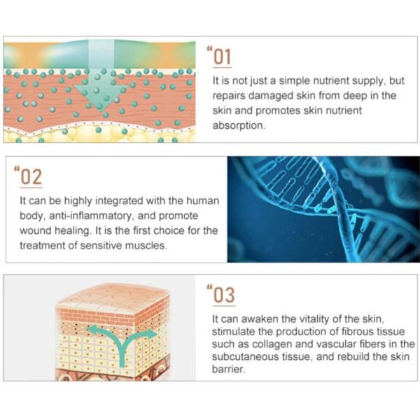 Анти- старея игла вводимое Mesotherapy младенца ракеты -носителя PDRN кожи