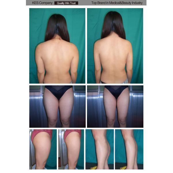 Vacuum Body Sculpting Machine with Cavitation IR RF Roller Massager