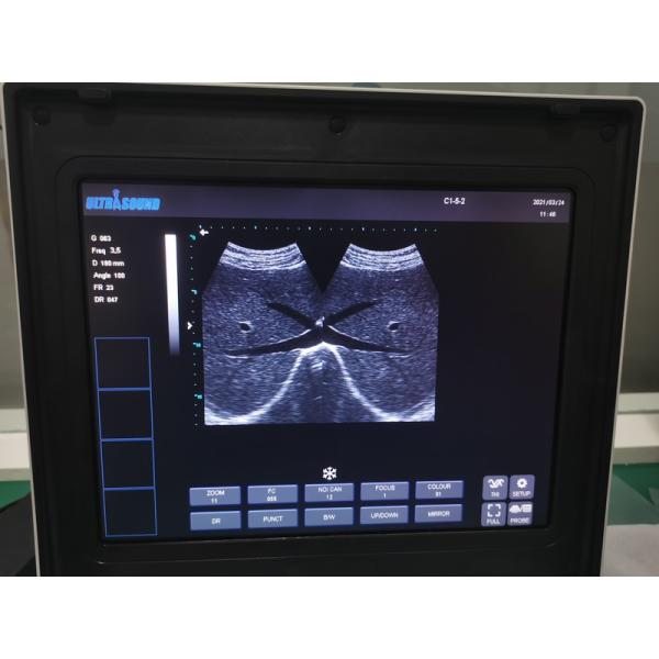Hospital Outside Diagnostic Linear Ultrasound Machine Dog Ultrasound Machine Laptop Cow Pregnancy Sheep Scanner