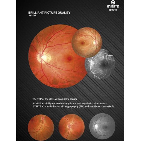 Automated Fundus Camera Clear Fundus Image Automated Focus 24 Megapixel mydriatic Anterior Photography Red-free optional FFA