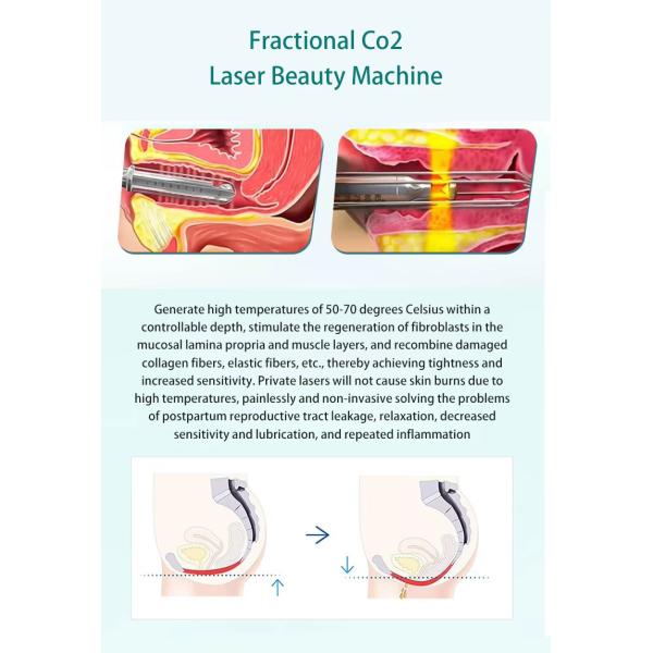 60W Skin Resurfacing Vaginal Tightening RF Tube 10600nm Fractional Co2 Laser Machine