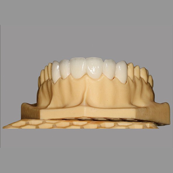 China Outsourcing Dental Lab | Aesthetic Porcelain Fused To Zirconia Bridge Hypoallergenic