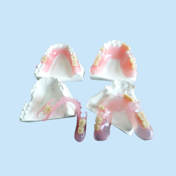 Восстановление кроны цифров PFM зубоврачебное