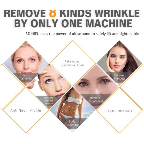 3d Hifu Ultrasound Machine / Accurate Tightening Body Slimming Facial Lifting Beauty Machine