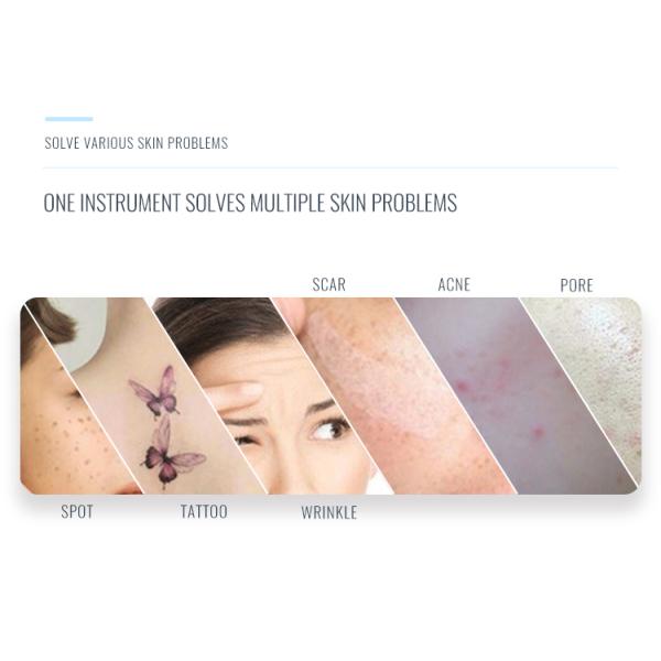 Лицевая машина 755nm 600ps удаления татуировки лазера пикосекунды красоты