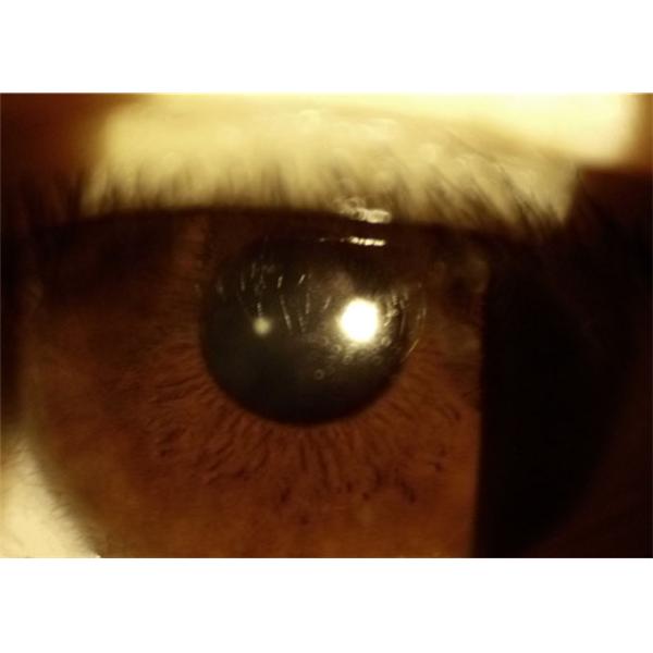 Оборудование офтальмологии заболеванием 10X цифров диагноза Anterior