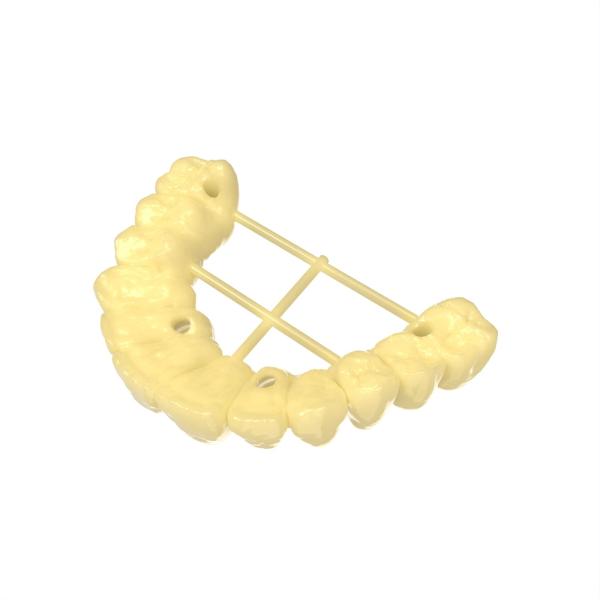 Patient Friendly Temporary Bridge Resin Biocompatible For Clinical Trials