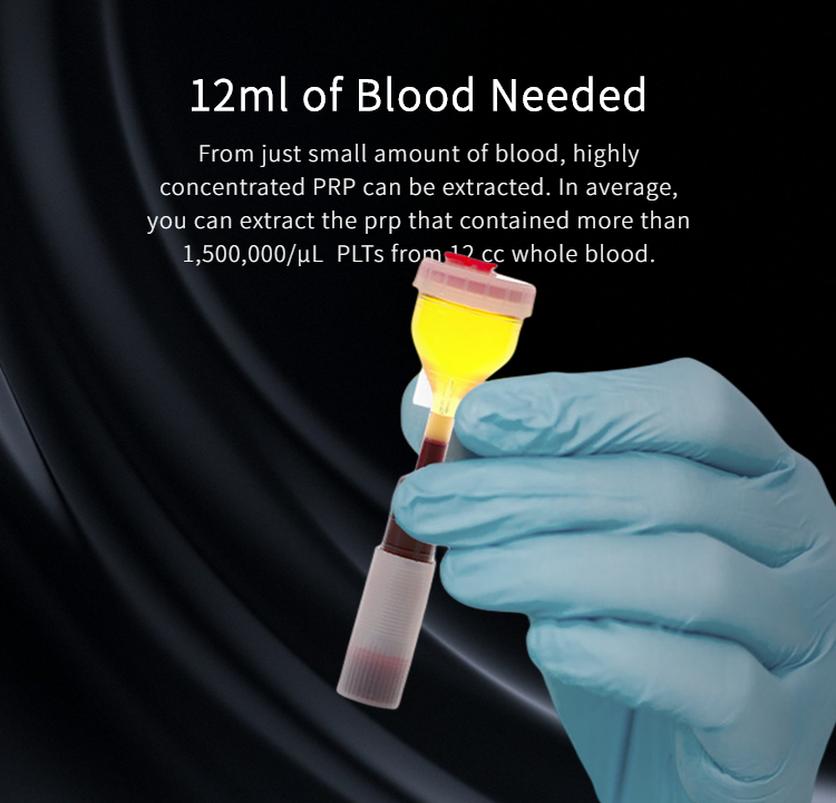 Hot Sale 15ml Y Centrifuge Tubes for Dental Lab, 12ml Blood Draw Volume, Sodium Citrate Anticoagulant, Low MOQ