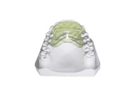 Customized Orthodontic Functional Appliance Removable Flat Guide Plane