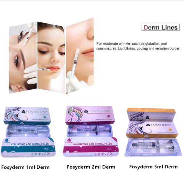 Заполнитель Fosyderm 1ml Derm стороны и губ извлекая морщинки