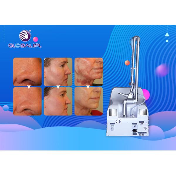Portable Fractional CO2 Laser Machine for Skin Rejuvenation  Scar Removal and Vaginal Therapy