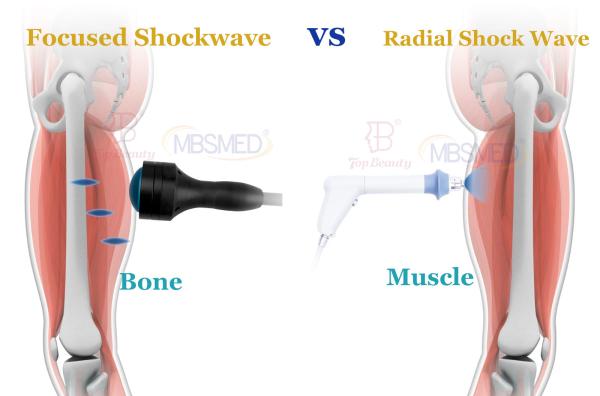 Electromagnetic Focused Shockwave Therapy Focus Shock Wave Fisioterapia Equipment