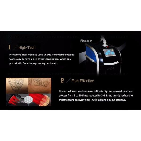 Korea Arm 532nm 1064nm 755nm Picosecond Laser Tattoo Removal Cholsma Removal