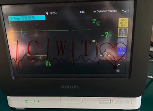 Réparation de chariot à moniteur patient de Philip MX400