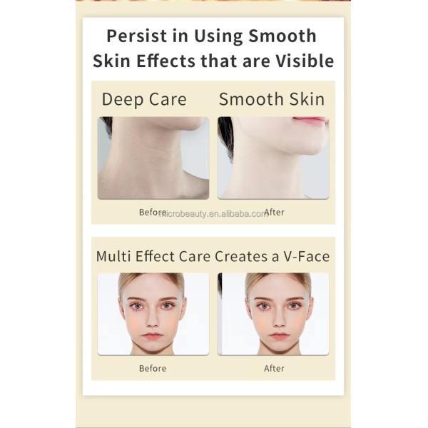 Masseur facial et cou liftant pour la maison, masseur liftant en forme de V pour raffermir et blanchir la peau