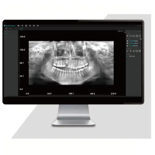 Dental Intelligent 2D CT Panorama X Ray Machine Irradiation Ceph Panoramic Imaging