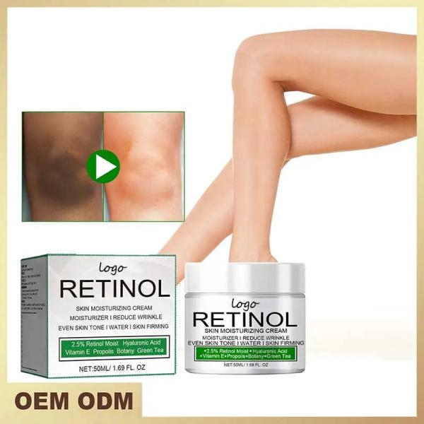 Creme de clareamento corporal soro de branqueamento remover a pigmentação da melanina clarear a pele da coxa interna creme hidratante