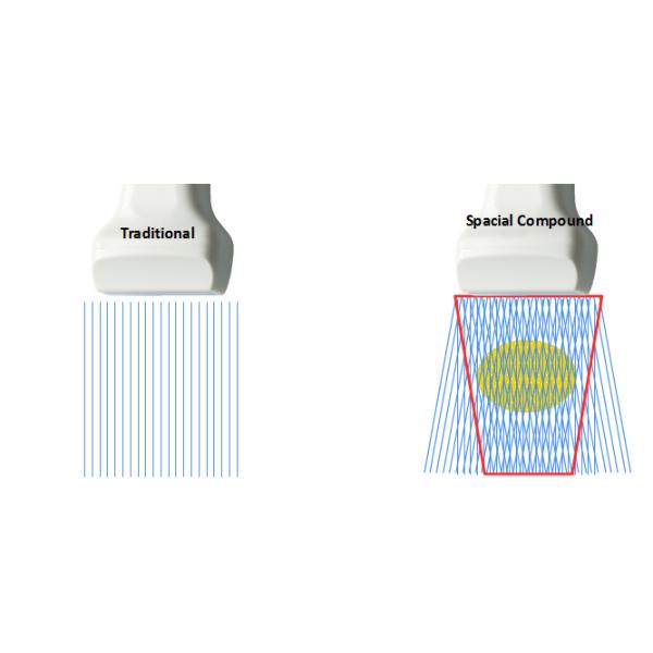 Trolley 4d Color Doppler Ultrasound Ecografo Sonoscape S50 Ultrasound
