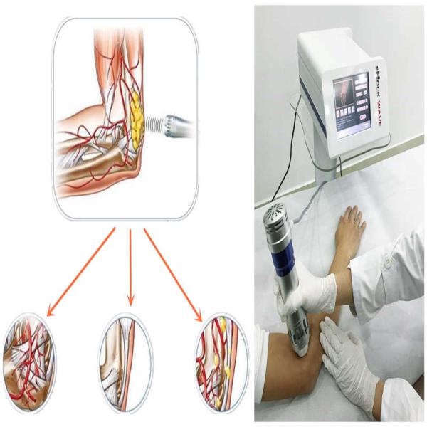 Машина терапией тела ESWT полная, машина удаления боли с 5 передатчиками