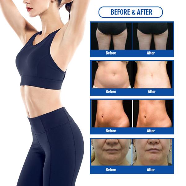 Facial Lifting Cryolipolysis Body Slimming Machine Loss Weight Fat Freezing