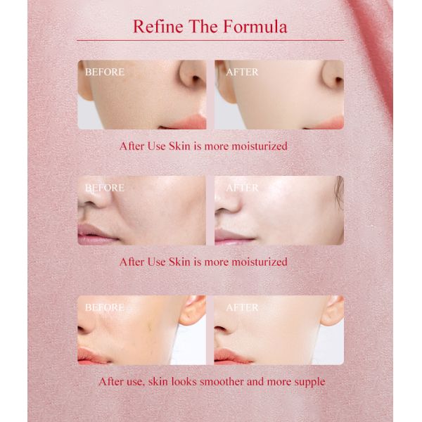 High Quality Organic Rose Water Facial Toner Moisturizing Spray Anti-Aging Private Label Face Care Skin Care Products Free