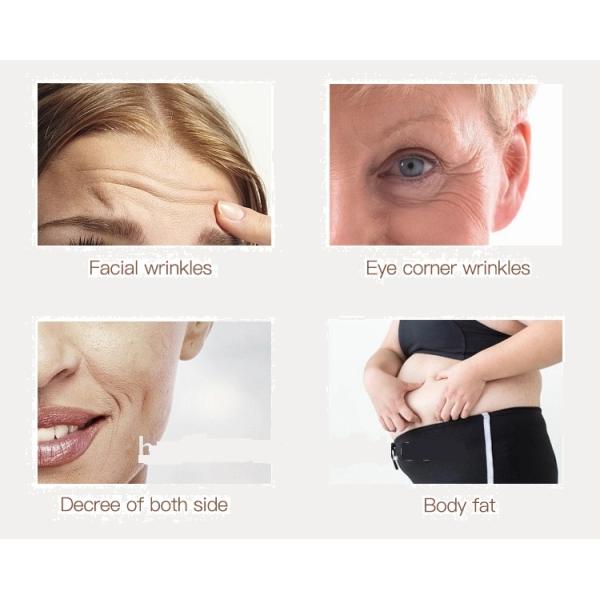 Zohonice RF 60w Cavitation Body Slimming Machine