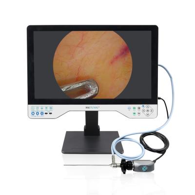 24 Endoscopic Endoscopy LED Light Source HD Endoscope Camera Recorder For Laparoscopy Cystoscope Surgeries