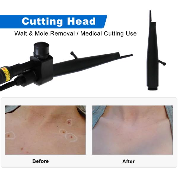 BV13 Portable Co2 Fractional Laser 60W Co2 Fraccionado Laser Vaginal Tightening Co2 Laser Machine For Skin