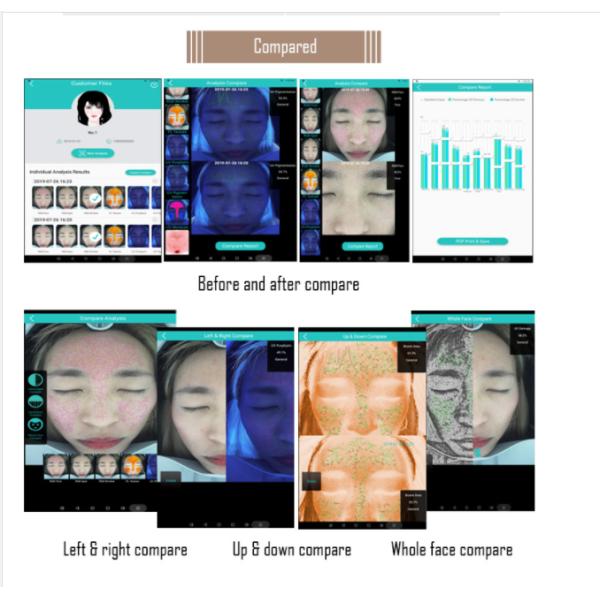 Skincare Wrinkle Pigmentation Acne Skin Analyser Machine 3D Smart Quizzes