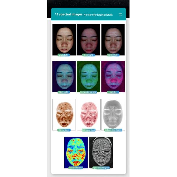 2in1 3 Cameras 3D AI Microscopic Scalp Handle Scalp Scanner Facial Skin Analyzer