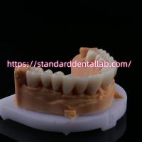 FDA haute esthétique pont dentaire en zirconium avec couronne dentaire en porcelaine en zirconium en Chine Laboratoire dentaire