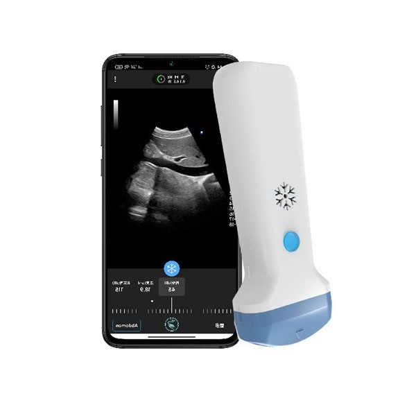 HDMI Output Wireless Convex Handheld Ultrasound Scanner | 3.6MHz Portable Color Doppler POCUS Ultrasound