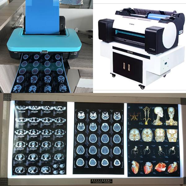 Inkjet médico X Ray Films do Dr. CT MRI 210 mícrons de rolo baixo azul da tinta 8x10 A4 A3 10inch