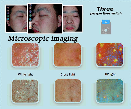 AI Skin Analyzer System With 11 Spectral Imaging Scalp Analysis