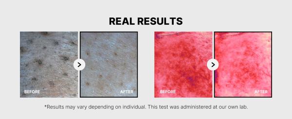 Breakout-Prone Skin Exfoliating Toner Pads Medicube Red Succinic Acid Panthenol Facial Peeling Pads with Niacinamide AHA BHA