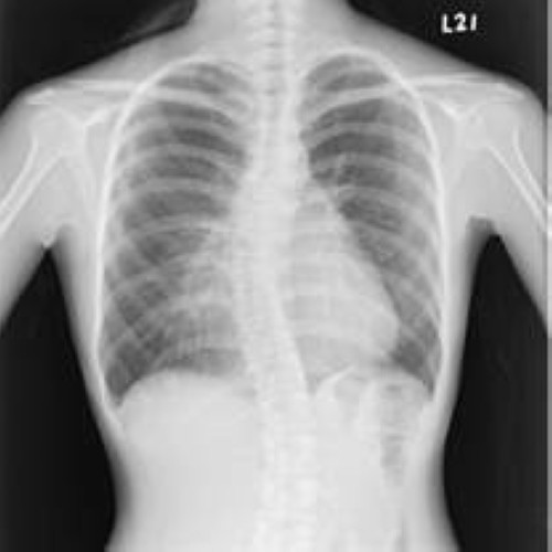 KND-A / F Medical X Ray Films