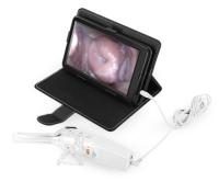 Auto - do Colposcope eletrônico Handheld de Digitas da inspeção detector Transvaginal com dimensão de 126×40×34mm