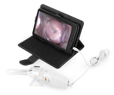 Self - Inspection Handheld Digital Electronic Colposcope Transvaginal Detector With Dimension of 126×40×34mm