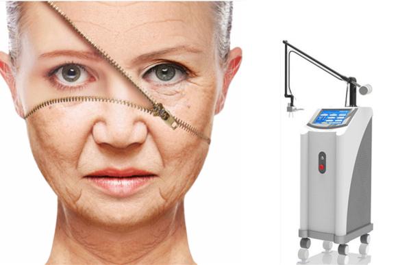 Professional scar and acne removal Fractional Laser Co2/ Vigenal tightening,rejuvenation CO2