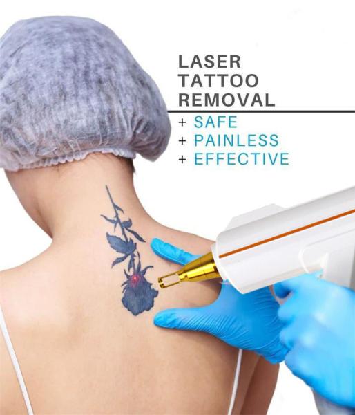 Skin Whitening Nail Fungus Laser Treatment Machine 1064nm 532nm 1320nm Wavelengths