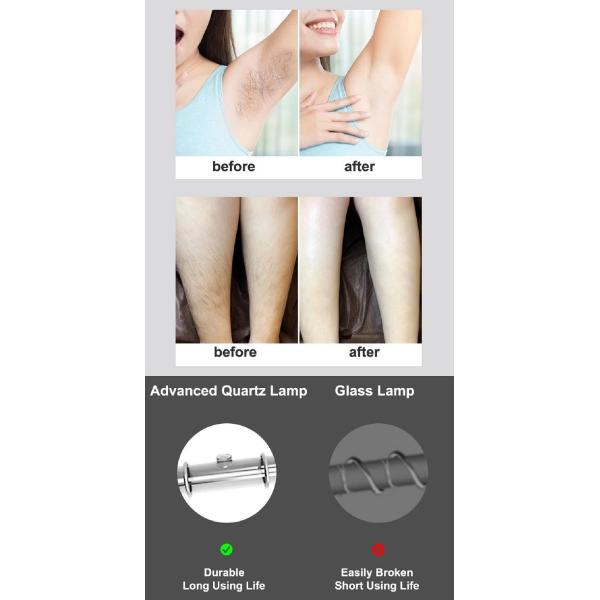 Удаление волос лазера IPL 5 шестерней CE ROHS перезаряжаемые