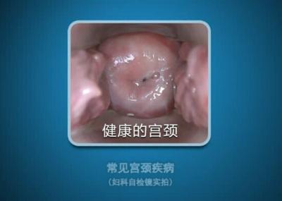 High Definition Video Gynecological Apparatus Digital Electronic Colposcope AV/USB output