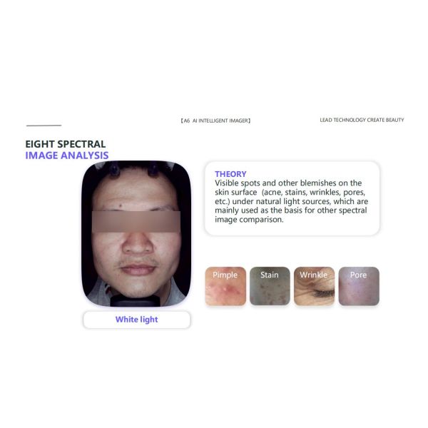 Beauty Spa Skin Care CentersDigital Partner For Skin Analysis With Al Intelligent System Acne Pigment Pores Test and Analysis