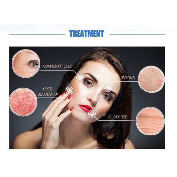 High Pressure Hydra Peeling Hydrotherapy Machines for Deep Cleansing and Rejuvenation