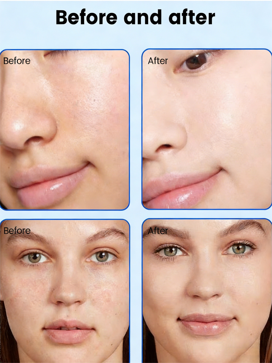 1000W Plasma Therapy Machine For Skin Tightening / Scar Repair /  Acne Treatment