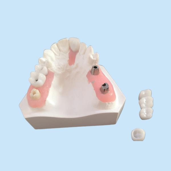 FDA Все цирконовые коронки с имплантированными протезами для стоматологической лаборатории